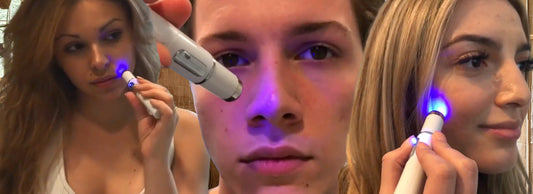 ClearifySkin™: A New Era in Acne Treatment