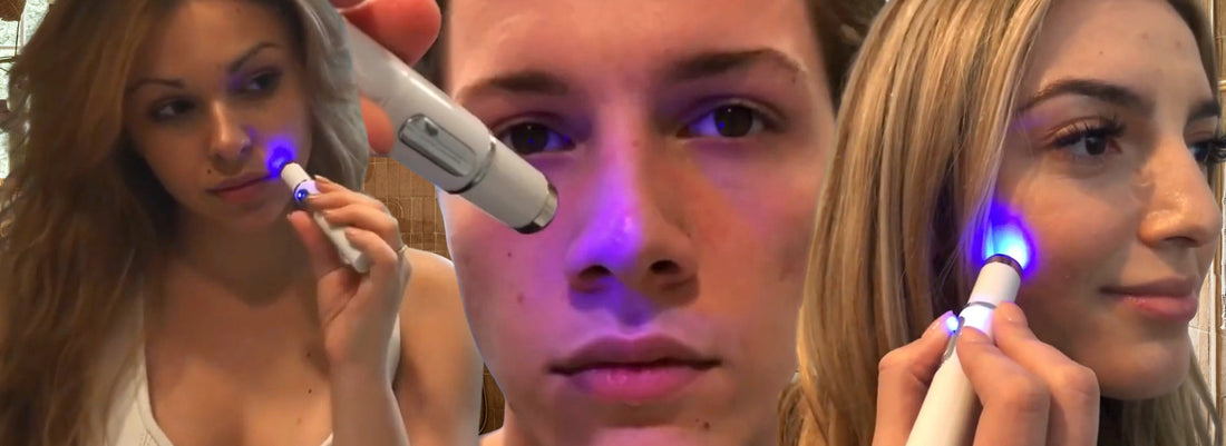 Blue Light Therapy for Acne: The Science Behind ClearifySkin™