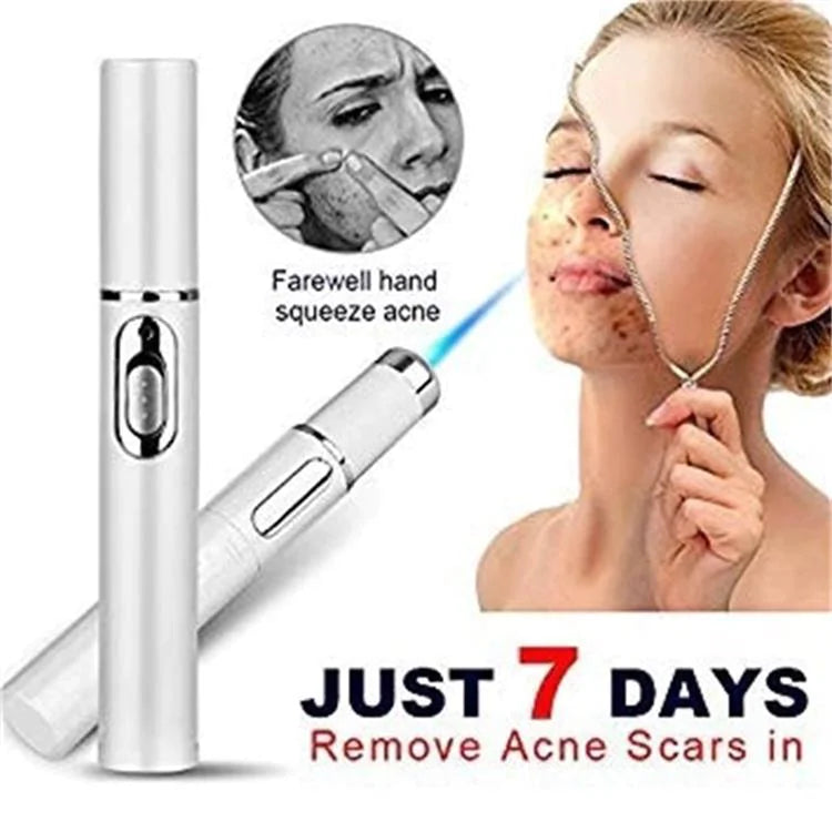 ClearifySkin Blue Light Acne Pen Treatment device removes acne scars in just 7 days - say farewell to hand squeezing acne with before and after comparison showing visible results
