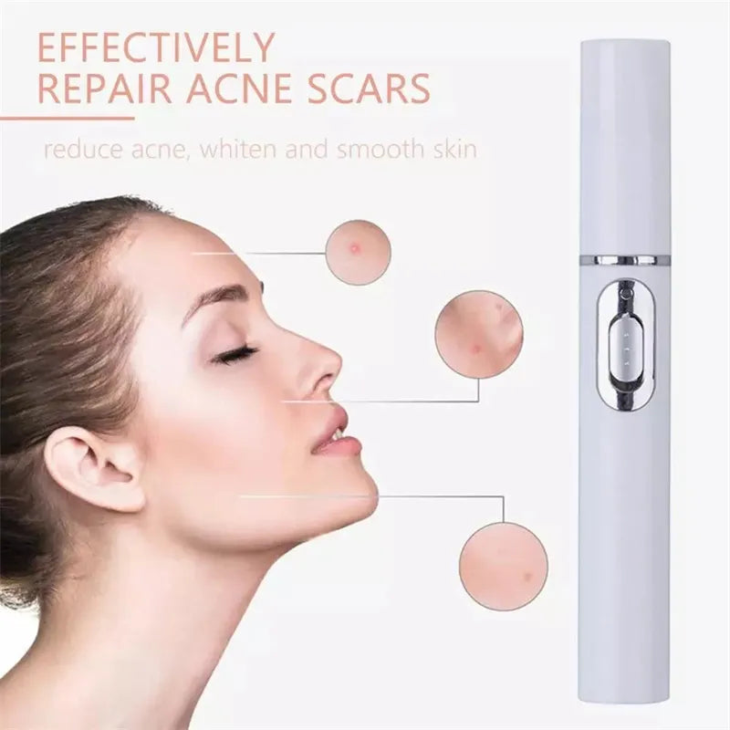 Woman with clear skin after using Blue Light Acne Treatment device to effectively repair acne scars, reduce acne, and achieve smoother skin - targeted treatment for problem areas
